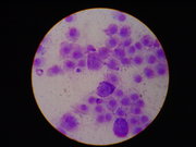 Mast cell tumor cytology